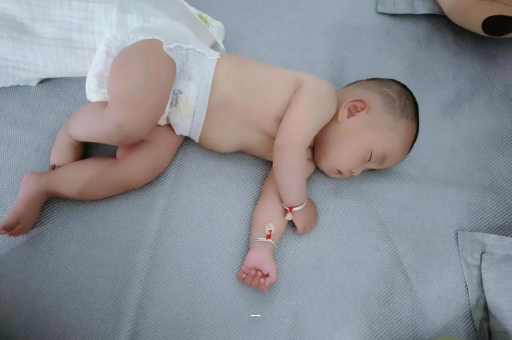 永兴宝宝脸上有白色斑块
